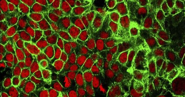 Researchers looking into genetic causes of cancer – CBS 19 News