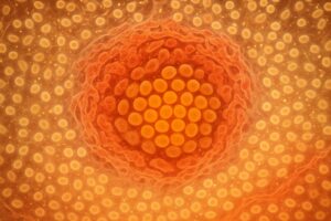 Dormant Breast Cancer Cells: Where They Hide in a Tumor
