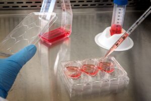 Scientists Turned an 80-Year-Old's Blood Into Young Brain Cells